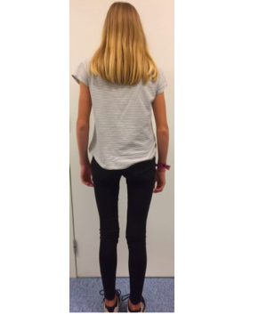 7: patiënte met brace
