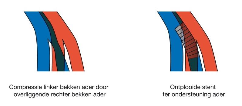 Aders
