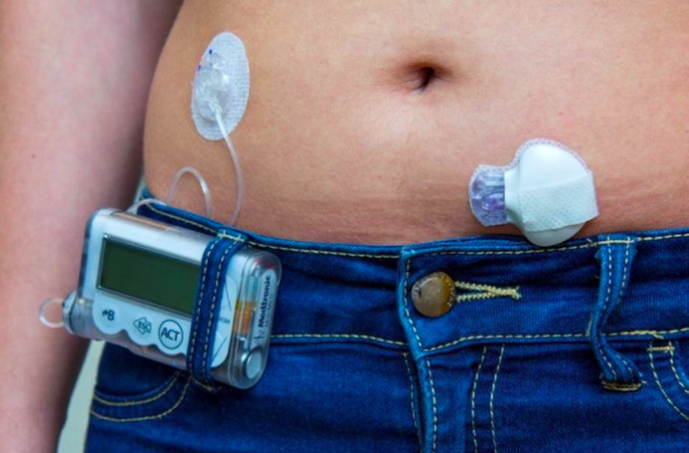 Het dragen van een RT-CGM systeem