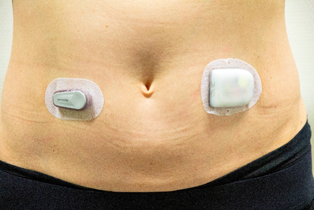 Het dragen van een RT-CGM systeem