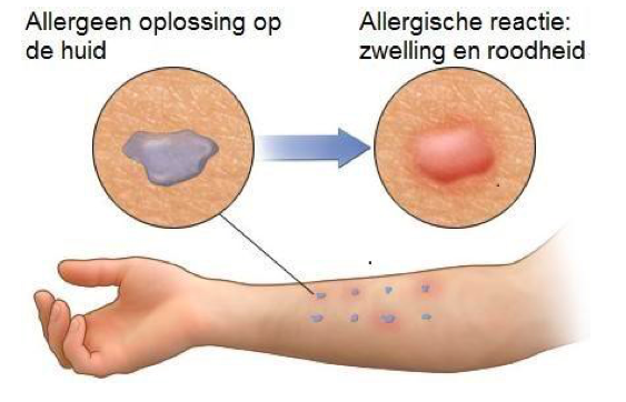 allergie test