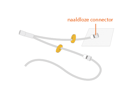 illustratie catheter