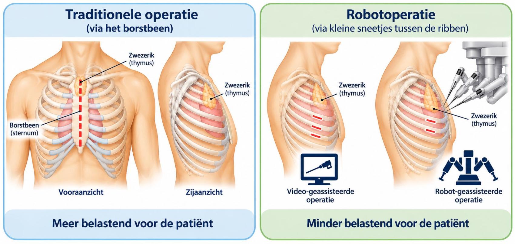Verschil tussen traditionele operatie en robotoperatie 