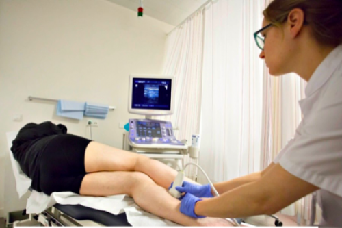 Endoveneuze ablatie van spataderen
