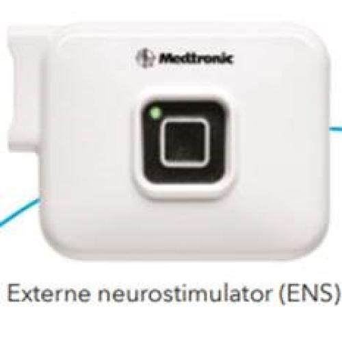 Externe neurostimulator (ENS)