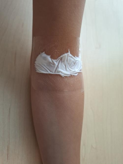 Eleboogplooi-creme-pleister
