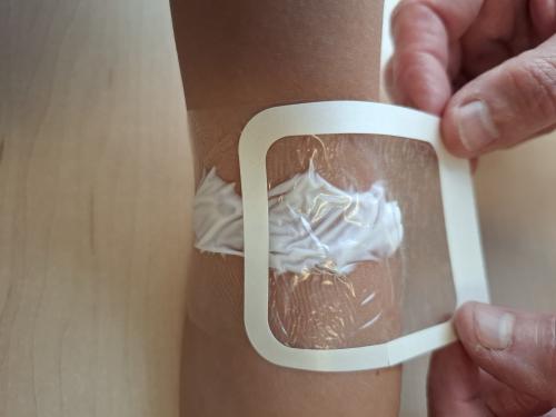 Elleboogplooi tweede pleister plakken