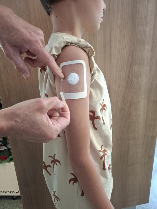 Voor vaccinatie: op de bovenarm (tussen de beide vingers)