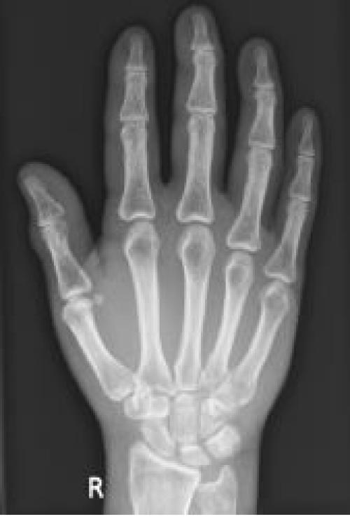foto van een hand