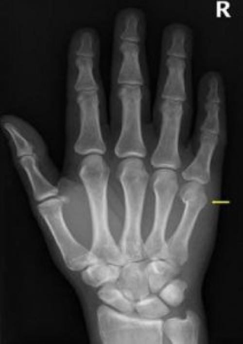 hand